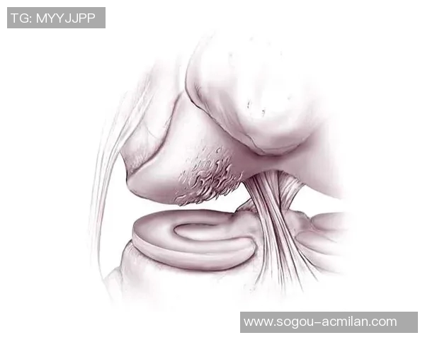 米兰三位医生一致认为马特塔膝盖软骨严重受损手术在即